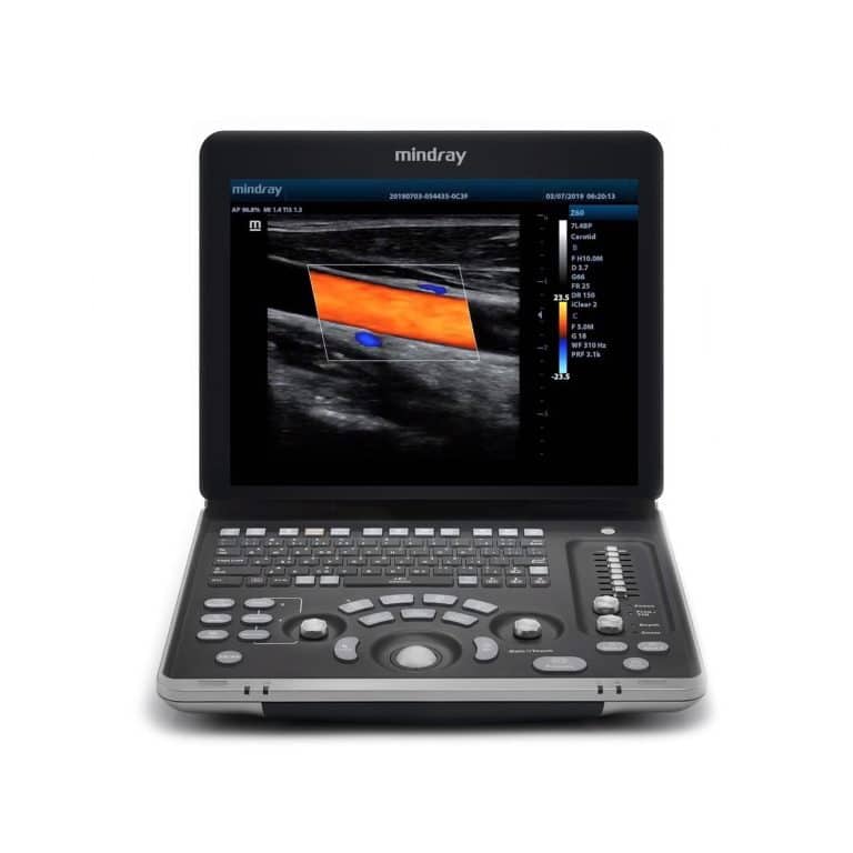 Ultrasonido Portátil Z60 Mindray - Sel Equipo Médico